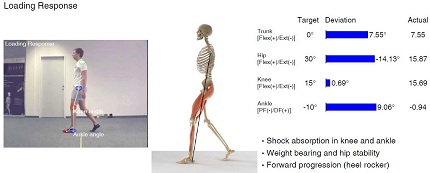example of clinical gait analysis